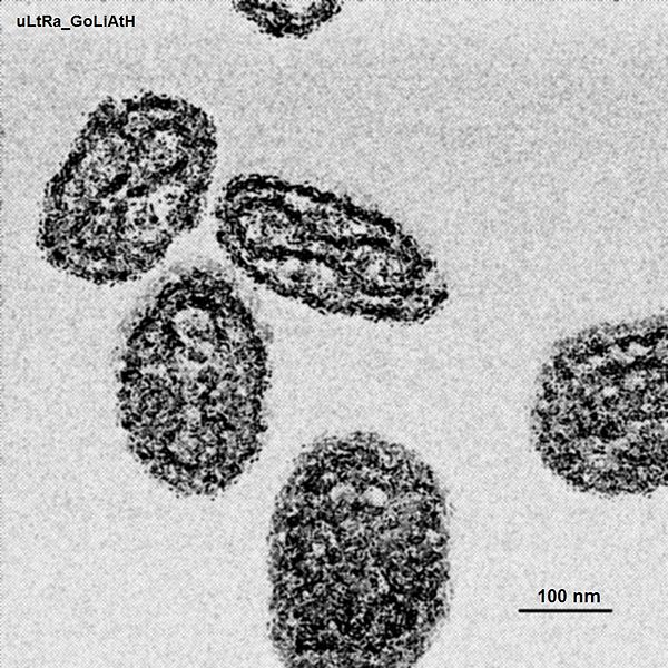 Variola virus.jpg