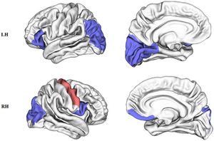 Surface mapping - altered network topology in early blind subjects.png