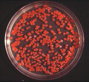 Serratia marcescens.jpg