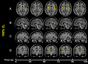 CO2-O2-fMRI-hyperoxia-over-time.png